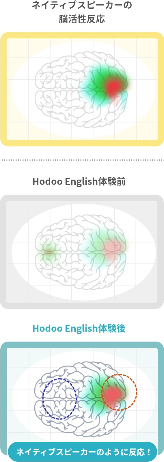 Hodoo Englishを行った学習者の脳が、ネイティブスピーカーのように反応したことを示した脳活性化反応の図